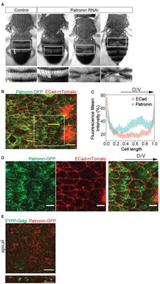 The Microtubule Minus-End Binding Protein Patronin Is Required for the Epithelial Remodeling in the Drosophila Abdomen